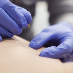 slider2 Fysio revalidatie Rembrandt fysiotherapie & revalidatie Amerongen Lienden Rhenen Duiven Veenendaal