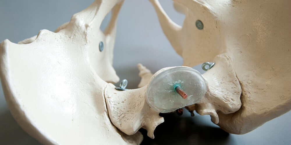 Vacature Bekkenfysiotherapeut Afbeelding van het bekken voor de vacature bekkenfysiotherapeut