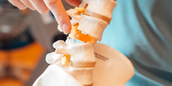 Hernia-pijn Foto van een therapeut in een blauw shirt wijst naar een model van een wervelkolom om hernia-pijn te ontwijken.